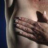 hand_over_breast_cancer