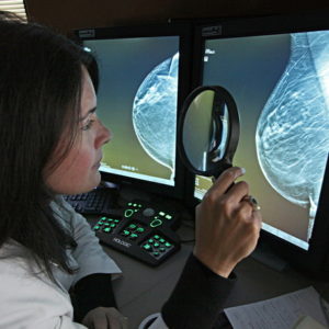 doctor analyzing mammogram