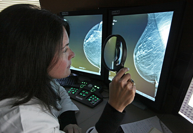 3D Mammogram Image 