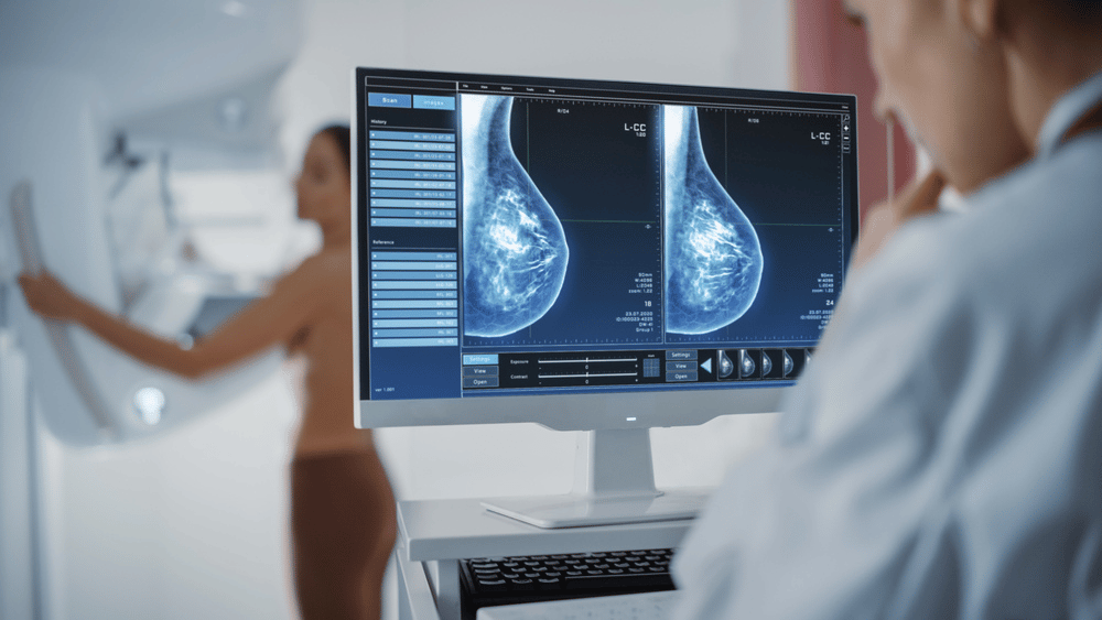 Breast Density & Your Breast Cancer Risk: What You Need to Know