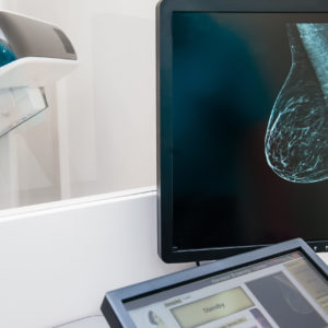 New Guidance Determines COVID Vaccines <br>Should Not Delay Mammogram Screenings