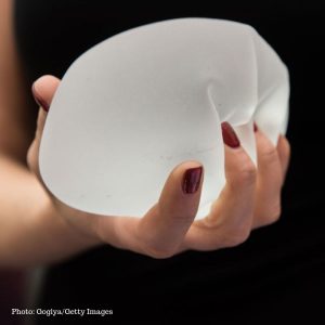 Female hand with red fingernails holding textured implant