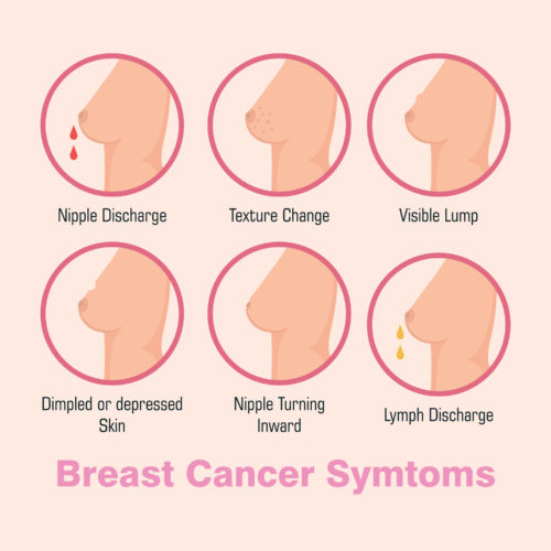 Explore Common Breast Cancer Myths