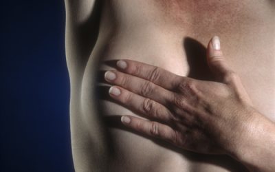 What Is Inflammatory Breast Cancer?