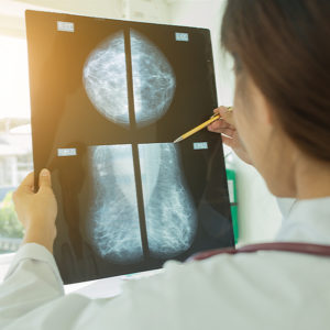 emale doctor looking at the Mammogram film image